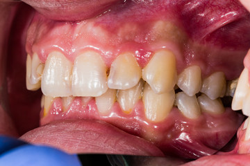 DIdactic exaples of dental problems