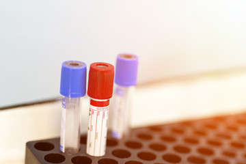 Lot of empty laboratory blood analysis tubes at medical center