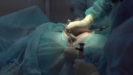 Operation using laparoscopic equipment. Surgeons team. Hospital.
