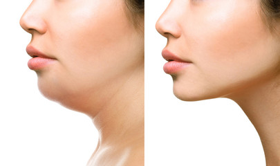 Part of face, woman with the double and perfect chin