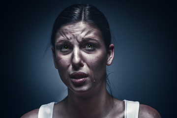 Close up portrait of a crying woman with bruised skin and black eyes