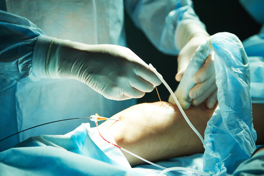 Surgery of varix vein