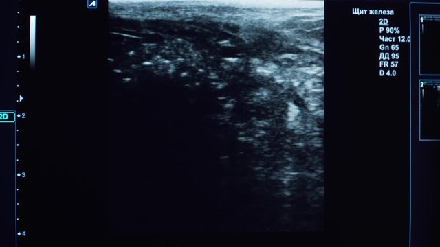 Ultrasound diagnostics with the image of internal organs on the screen of the monitor in a veterinary clinic. Medical ultrasound machine. Screen ultrasound machine. symbol diagnostics in healthcare.