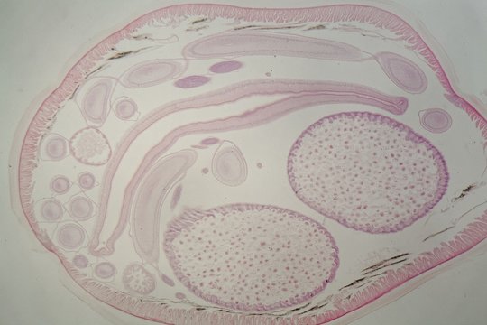 Parasitic nematode worm (Ascaris sp.) under the microscope