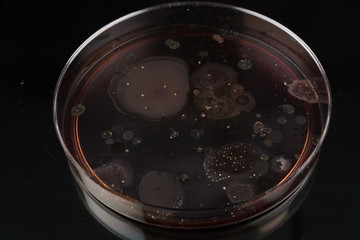 growth of microorganisms in a Petri dish, Bacteria, yeast and mold growing on an agar plate.