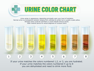 Urine Color Chart 1