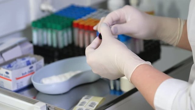 Nurse puts a bar code on a test tube with a blood test