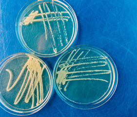 Petri dishes with biological samples  for medical and biological analyzes