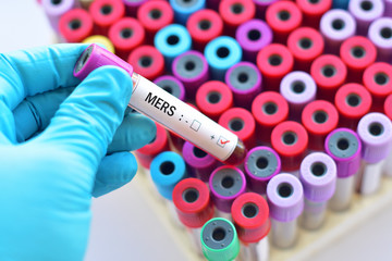 Fototapeta premium Blood sample positive with MERS-CoV (Middle East respiratory syndrome coronavirus)