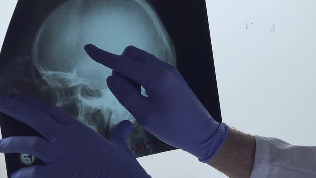 Doctor examining x-ray of the patient's skull in a medical clinic