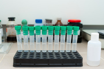 test tubes at clinic laboratory