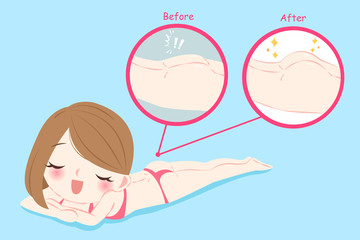 woman with butt implant