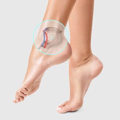 Circle shows robotic detail inside leg.