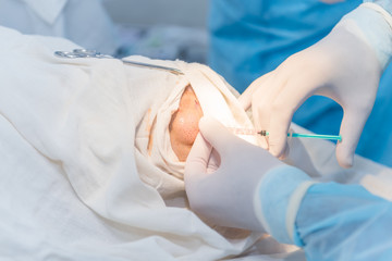 Fototapeta premium hands of an anesthesiologist with a syringe, anesthetizing the patient