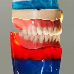 False teeth prosthesis