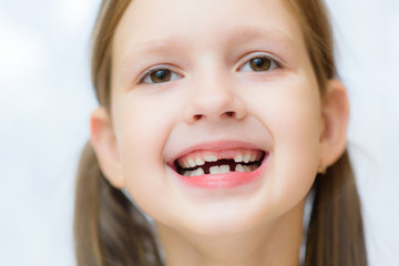 funny toothless girl laughing with his mouth open