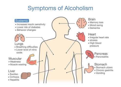 Symptom of alcoholism patient. Illustration about health problem of people with alcohol addiction.
