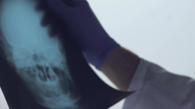 Doctor examining x-ray of the patient's skull in a medical clinic. Healthcare professional analyzing imaging test of human head.
