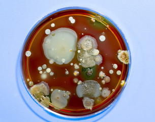 A petri dish with colonies of microorganisms for bacteriological analysis in a microbiological...