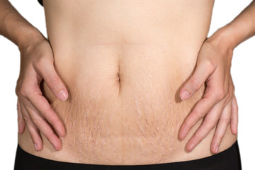 Woman belly fat pattern