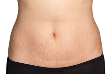 Woman belly fat pattern