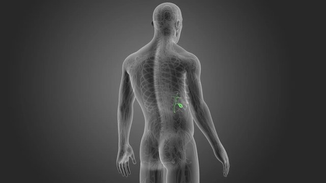 Gallbladder with CS