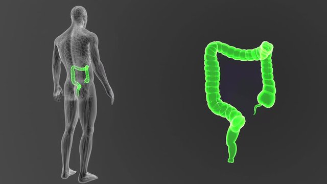 Large Intestine zoom with CS