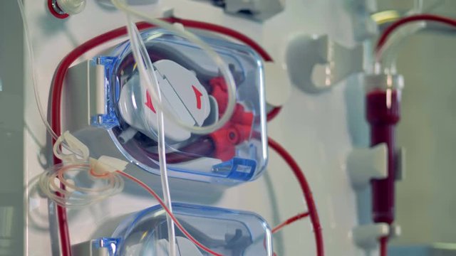 Modern medical equipment for hemodialysis procedure. Modern medical equipment concept.