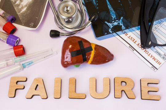 Liver failure concept photo. Liver figure with glued black cross is near word liver failure and set of medical tests (MRI, ultrasound, analysis), diagnostic devices (stethoscope, test tubes, syringes)