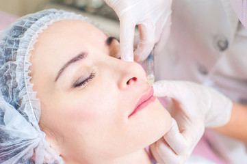 .Lip augmentation, cosmetology, beauty, plastic surgery