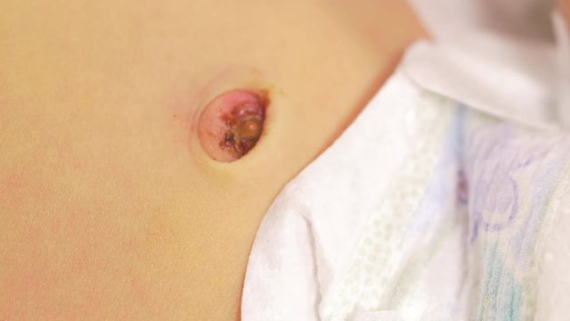 Infant baby breathing - close up on tummy with ambilical cord