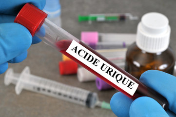 Acide urique 