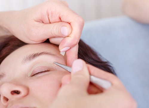 Surgeon applies a bandage to the female patient's eyelids after a blepharoplasty operation