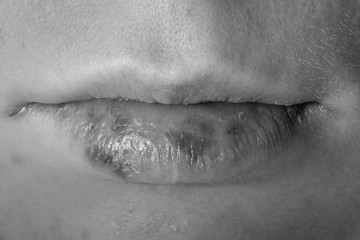 Lips of a woman with a wound macro, black and white photo