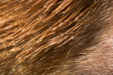 Short fair man hair in a rinse, macro