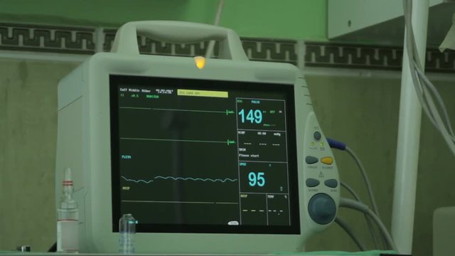 EKG machine at veterinary clinic during surgery, Ecg monitor patient's condition in operating room, heartbeat on screen,heart rate,blood pressure.