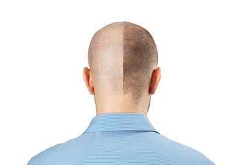 Whiite bald man in a blue shirt  on a white background. Split personality.