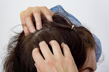 Woman controls head on hair loss