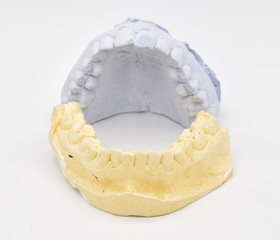 Plaster tooth molds arranged on seamless white background