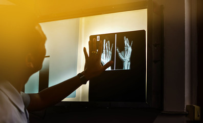 Medical doctor looking at a x-ray image in the hospital