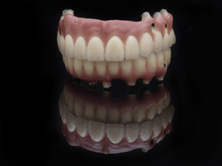  Complete prosthesis dental screwed over black mirror. Reflection