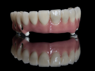 Complete lower prosthesis dental screwed over black glass.