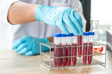 scientist or doctor hand select blood test tube in rack