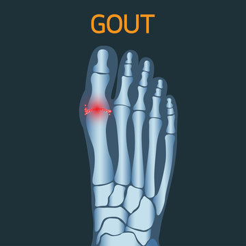 Gout vector logo icon illustration