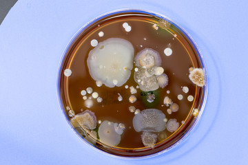 A petri dish with colonies of microorganisms for bacteriological analysis in a microbiological laboratory
