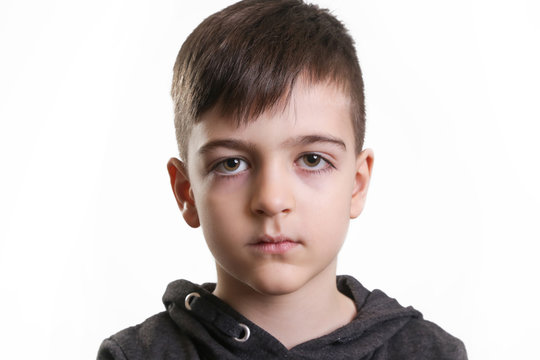 Studio Portrait Of Preschool 5 Yerars Old Boy On The White Background - Neutral Facial Expression