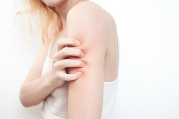 Itchy skin, girl cesit hand