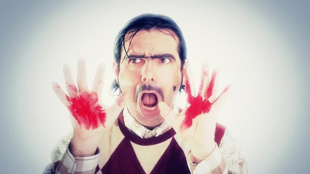 An ugly nerd showing his hands, full of blood.
