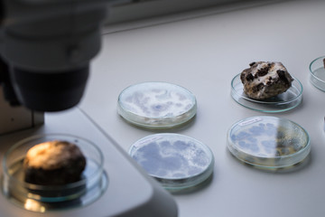 Asperillus niger in petri dish under the microscopic, Microbiology for education in laboratories.