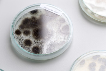 Asperillus niger in petri dish under the microscopic, Microbiology for education in laboratories.